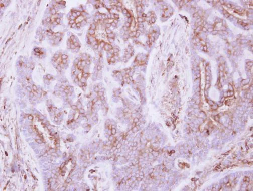 Immunohistochemistry (Formalin/PFA-fixed paraffin-embedded sections) - Anti-TIE2 antibody - N-terminal (AB227219)