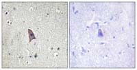 Immunohistochemistry (Formalin/PFA-fixed paraffin-embedded sections) - Anti-TIE2 (phospho Y1102) antibody (AB111585), expandable thumbnail