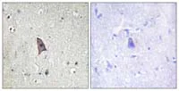 Immunohistochemistry (Formalin/PFA-fixed paraffin-embedded sections) - Anti-TIE2 (phospho Y1102) antibody (AB111585)