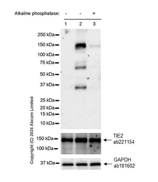 Western blot - Anti-TIE2 (phospho Y992) antibody [EPR27958-1] - BSA and Azide free (AB321884)