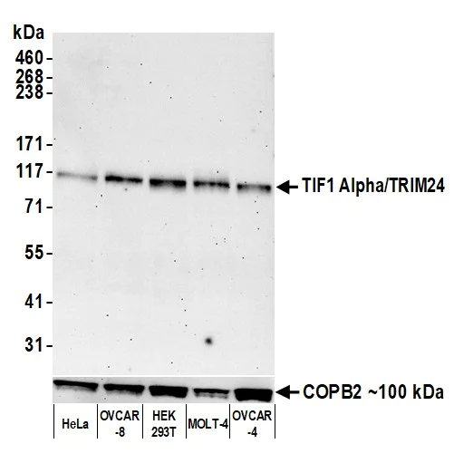 Western blot - Anti-TIF1 Alpha/TRIM24 antibody [BLR225K] - BSA free (AB314090)