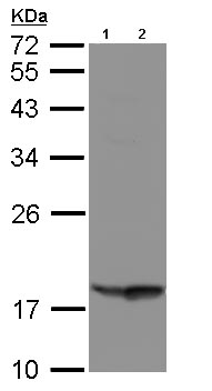Western blot - Anti-TIG3 antibody (AB96468)