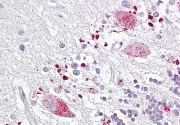 Immunohistochemistry (Formalin/PFA-fixed paraffin-embedded sections) - Anti-TIGAR antibody (AB189164)