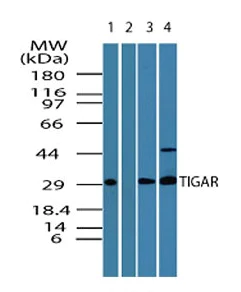 Western blot - Anti-TIGAR antibody (AB189164)