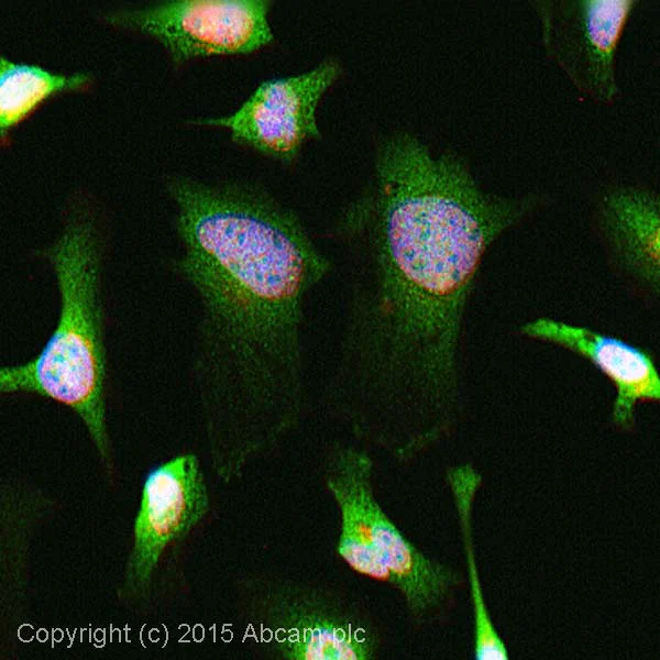 Immunocytochemistry/ Immunofluorescence - Anti-TIGAR antibody (AB37910)