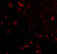 Immunocytochemistry/ Immunofluorescence - Anti-TIGAR antibody (AB62533)