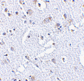 Immunohistochemistry (Formalin/PFA-fixed paraffin-embedded sections) - Anti-TIGAR antibody (AB62533)
