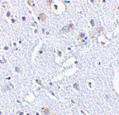 Immunohistochemistry (Formalin/PFA-fixed paraffin-embedded sections) - Anti-TIGAR antibody (AB62533)