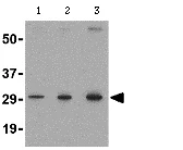 Western blot - Anti-TIGAR antibody (AB62533)
