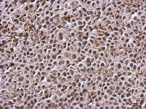Immunohistochemistry (Formalin/PFA-fixed paraffin-embedded sections) - Anti-TIGAR antibody - C-terminal (AB137573)