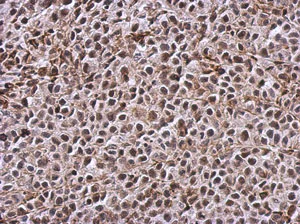 Immunohistochemistry (Formalin/PFA-fixed paraffin-embedded sections) - Anti-TIGAR antibody - C-terminal (AB137573)