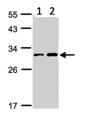 Western blot - Anti-TIGAR antibody - C-terminal (AB137573)