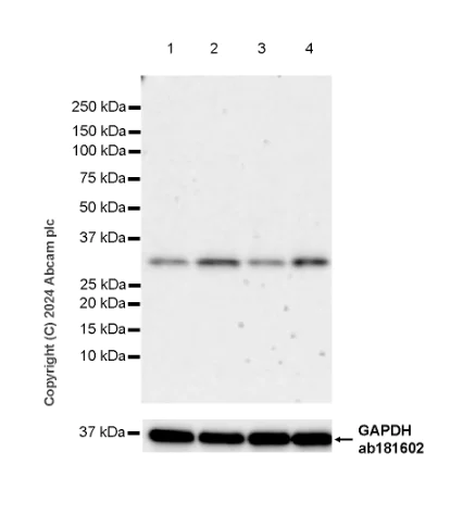 Western blot - Anti-TIGAR antibody [EPR29002-30] - BSA and Azide free (AB318981)