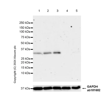 Western blot - Anti-TIGAR antibody [EPR29002-30] - BSA and Azide free (AB318981)