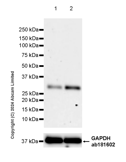 Western blot - Anti-TIGAR antibody [EPR29002-30] - BSA and Azide free (AB318981)