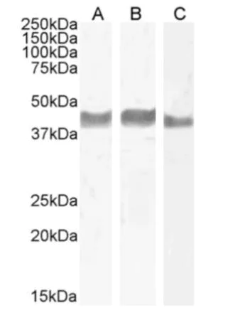 Western blot - Anti-TIGIT antibody [1B4] (AB288419)