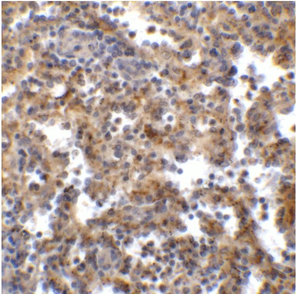 Immunohistochemistry (Formalin/PFA-fixed paraffin-embedded sections) - Anti-TIGIT antibody [2C7] - BSA and Azide free (AB289565)