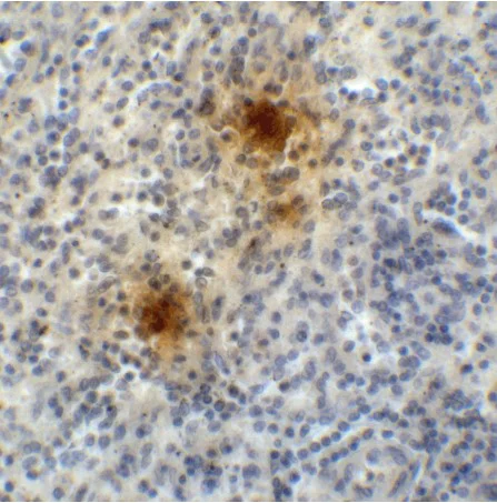 Immunohistochemistry (Formalin/PFA-fixed paraffin-embedded sections) - Anti-TIGIT antibody [2D7] - BSA and Azide free (AB289566)
