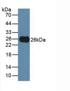Western blot - Anti-TIGIT antibody (AB231191)