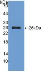 Western blot - Anti-TIGIT antibody (AB231191)