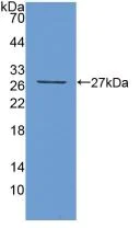 Western blot - Anti-TIGIT antibody (AB233404)