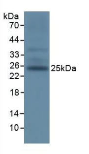 Western blot - Anti-TIGIT antibody (AB233404)