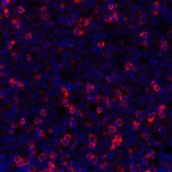 Immunohistochemistry (Formalin/PFA-fixed paraffin-embedded sections) - Anti-TIGIT antibody [BLR047F] - BSA free (AB243903)