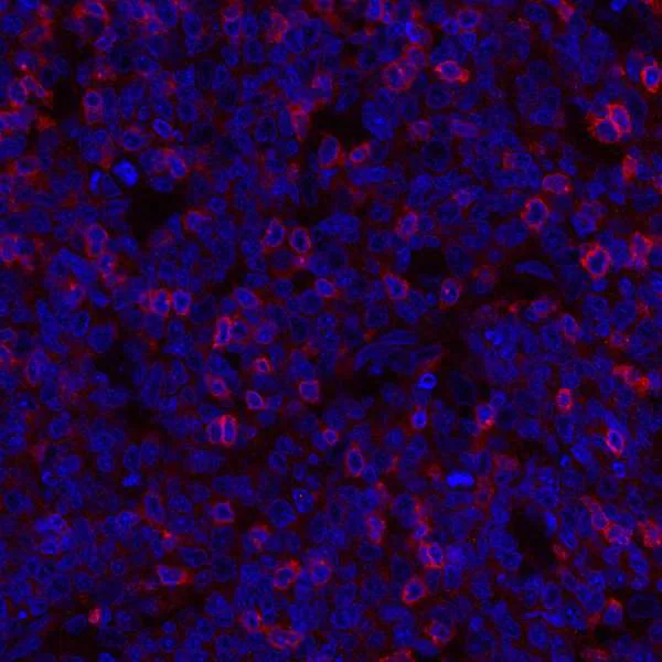 Immunohistochemistry (Formalin/PFA-fixed paraffin-embedded sections) - Anti-TIGIT antibody [BLR047F] - BSA free (AB243903)