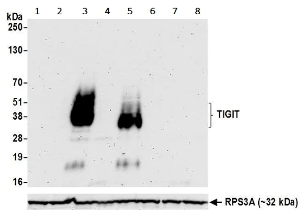 Western blot - Anti-TIGIT antibody [BLR047F] - BSA free (AB243903)