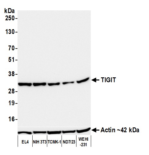 Western blot - Anti-TIGIT antibody [BLR235K] - BSA free (AB314059), expandable thumbnail