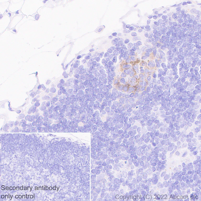 Immunohistochemistry (Formalin/PFA-fixed paraffin-embedded sections) - Anti-TIGIT antibody [EPR26037-152] (AB300073)