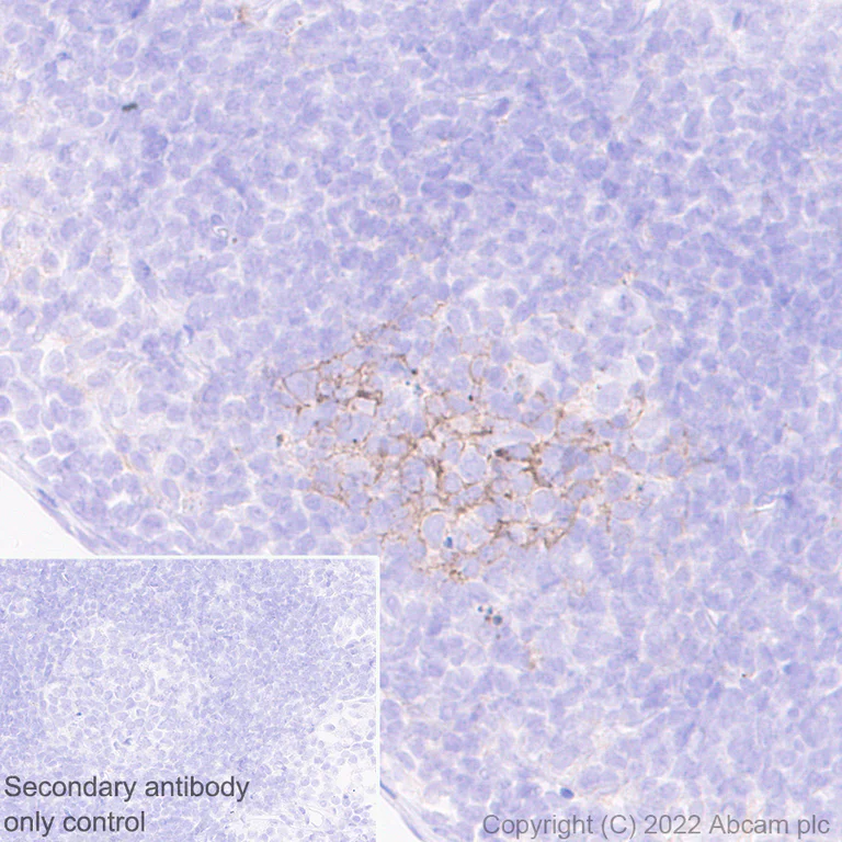 Immunohistochemistry (Formalin/PFA-fixed paraffin-embedded sections) - Anti-TIGIT antibody [EPR26037-152] (AB300073)