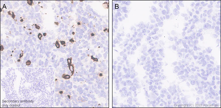 Immunohistochemistry (Formalin/PFA-fixed paraffin-embedded sections) - Anti-TIGIT antibody [EPR26037-152] (AB300073)