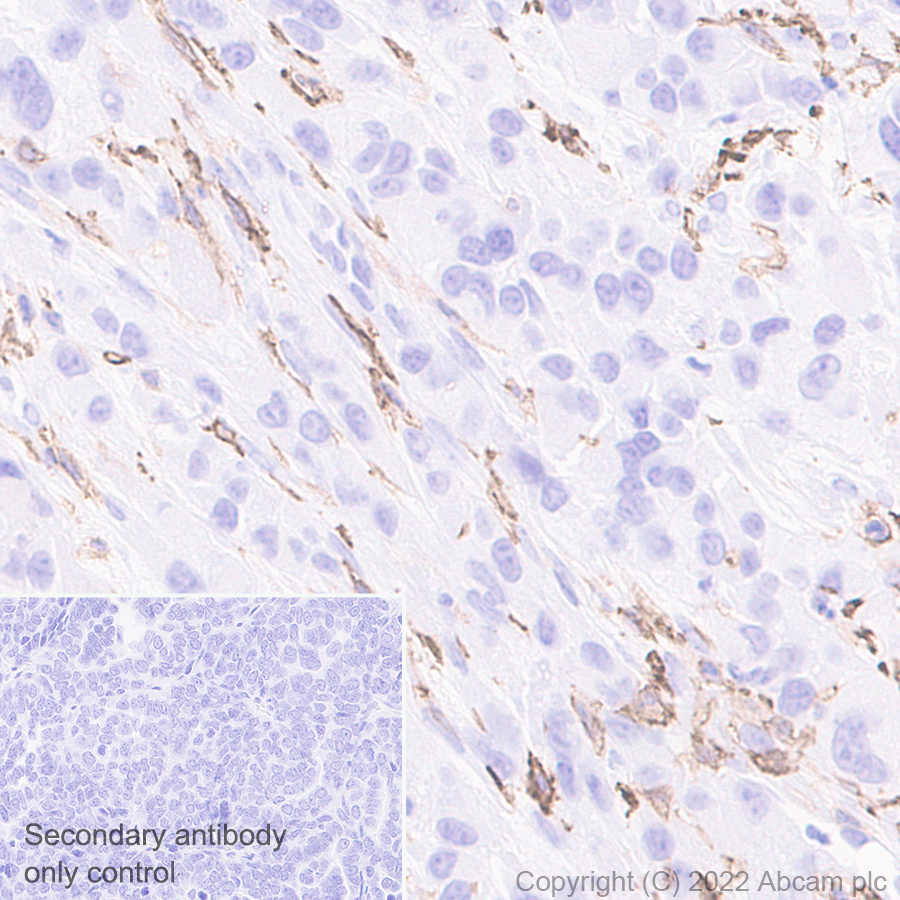 Immunohistochemistry (Formalin/PFA-fixed paraffin-embedded sections) - Anti-TIGIT antibody [EPR26037-152] (BSA and Azide free) (AB300074), expandable thumbnail