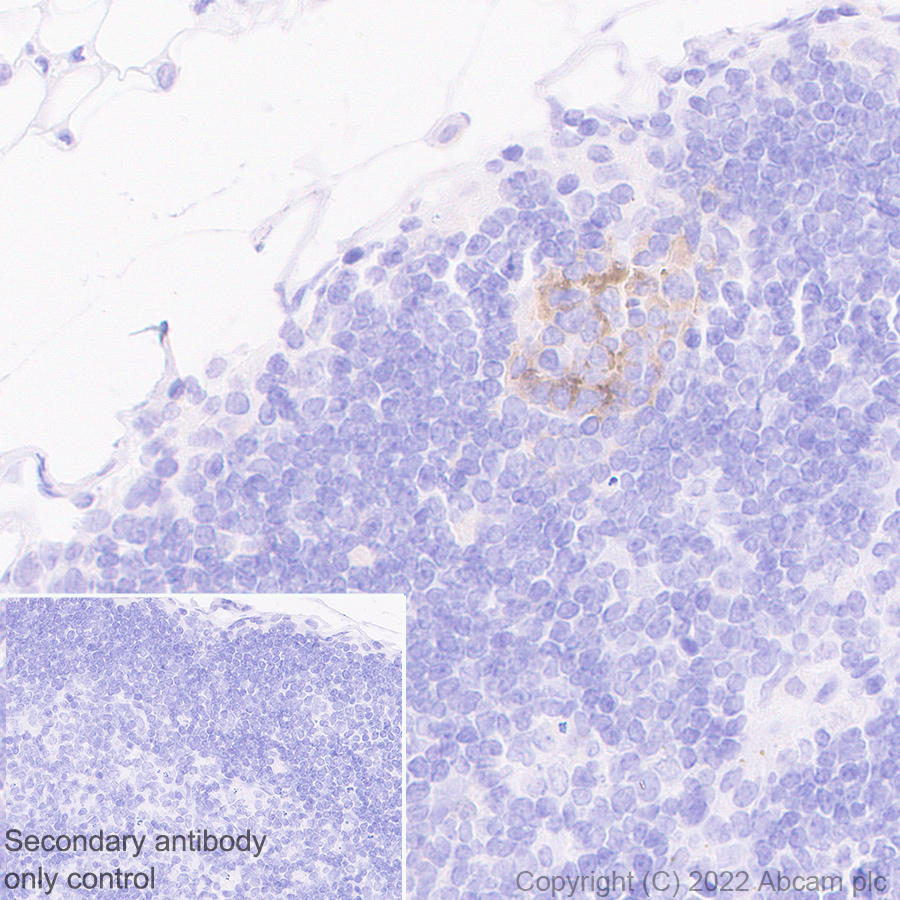 Immunohistochemistry (Formalin/PFA-fixed paraffin-embedded sections) - Anti-TIGIT antibody [EPR26037-152] (BSA and Azide free) (AB300074), expandable thumbnail