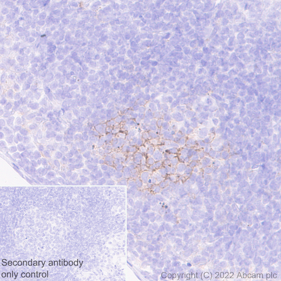 Immunohistochemistry (Formalin/PFA-fixed paraffin-embedded sections) - Anti-TIGIT antibody [EPR26037-152] (BSA and Azide free) (AB300074), expandable thumbnail