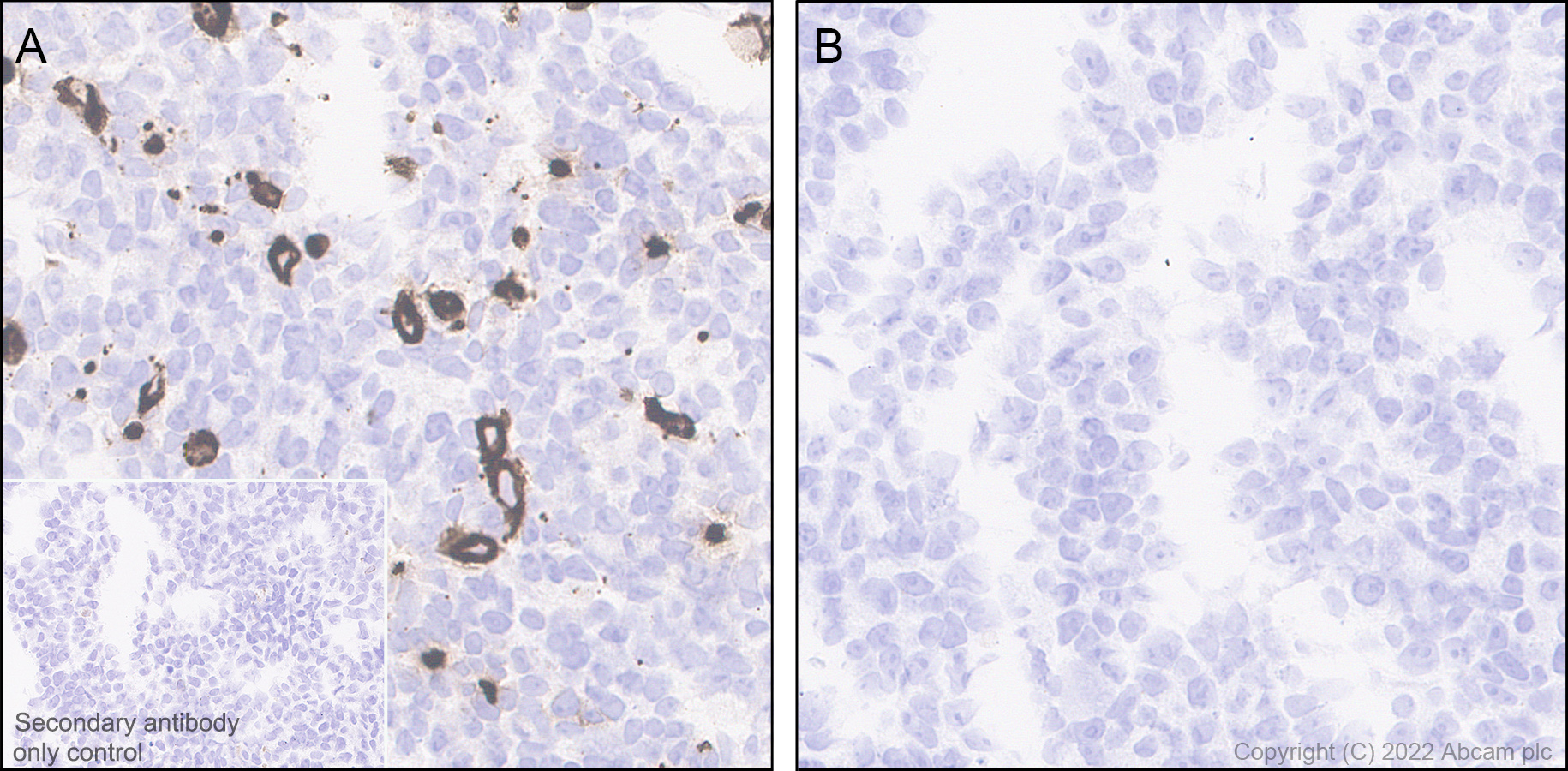 Immunohistochemistry (Formalin/PFA-fixed paraffin-embedded sections) - Anti-TIGIT antibody [EPR26037-152] (BSA and Azide free) (AB300074), expandable thumbnail