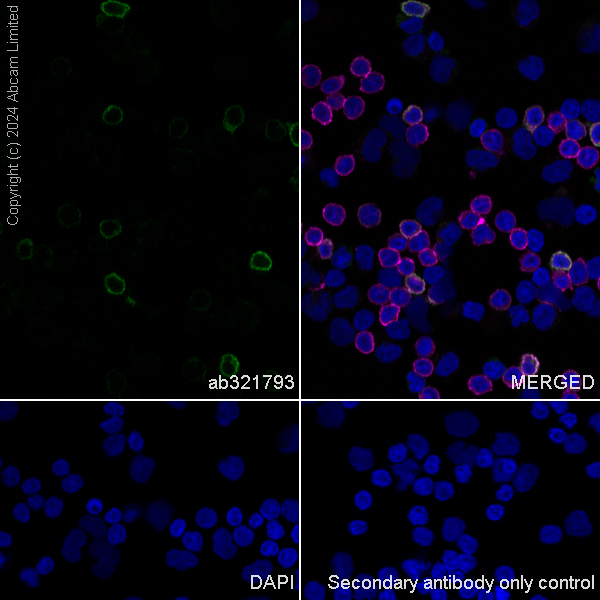 Immunocytochemistry/ Immunofluorescence - Anti-TIGIT antibody [EPR28146-94] (AB321793), expandable thumbnail
