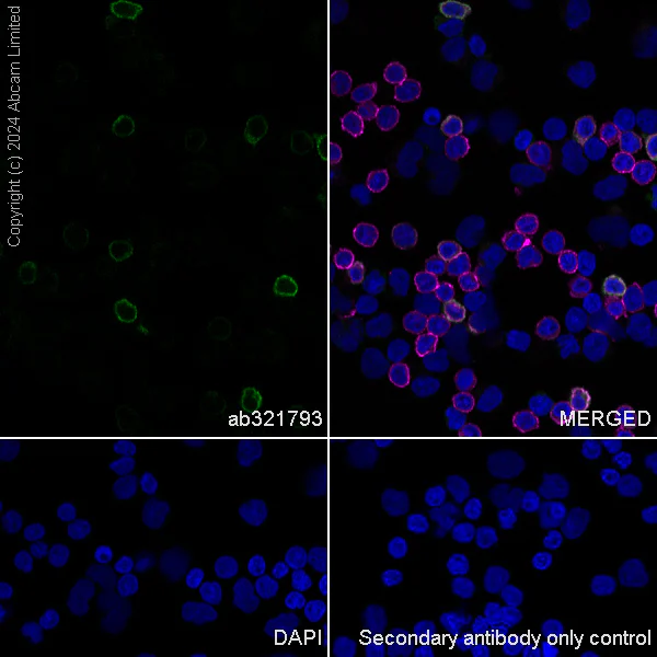 Immunocytochemistry/ Immunofluorescence - Anti-TIGIT antibody [EPR28146-94] - BSA and Azide free (AB321794)
