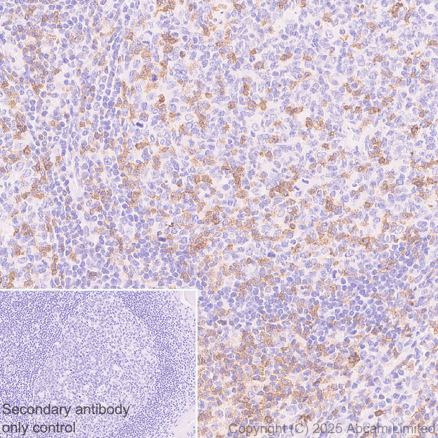 Immunohistochemistry (Formalin/PFA-fixed paraffin-embedded sections) - Anti-TIGIT antibody [EPR29350-46] (AB324237), expandable thumbnail