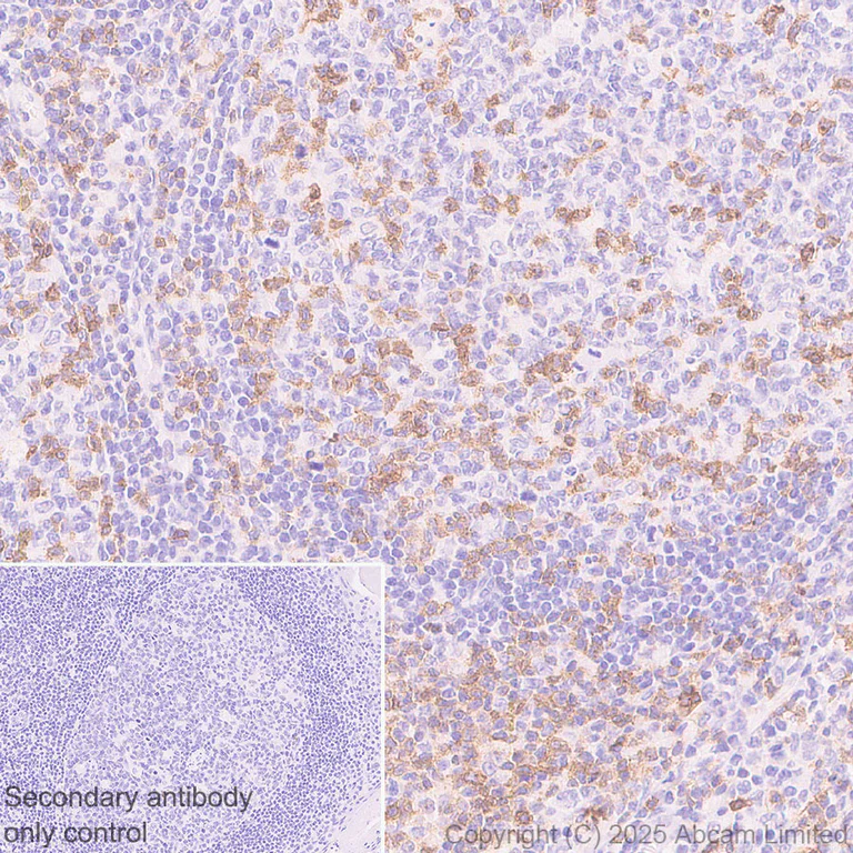 Immunohistochemistry (Formalin/PFA-fixed paraffin-embedded sections) - Anti-TIGIT antibody [EPR29350-46] (AB324237)