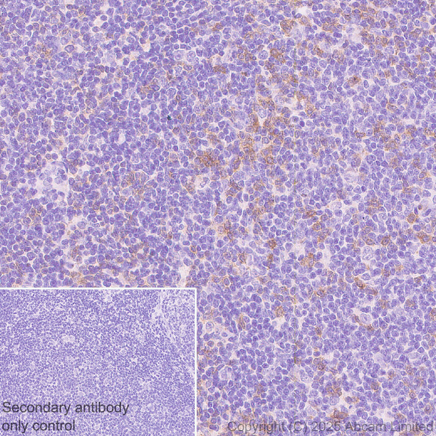 Immunohistochemistry (Formalin/PFA-fixed paraffin-embedded sections) - Anti-TIGIT antibody [EPR29350-46] (ab324237), expandable thumbnail