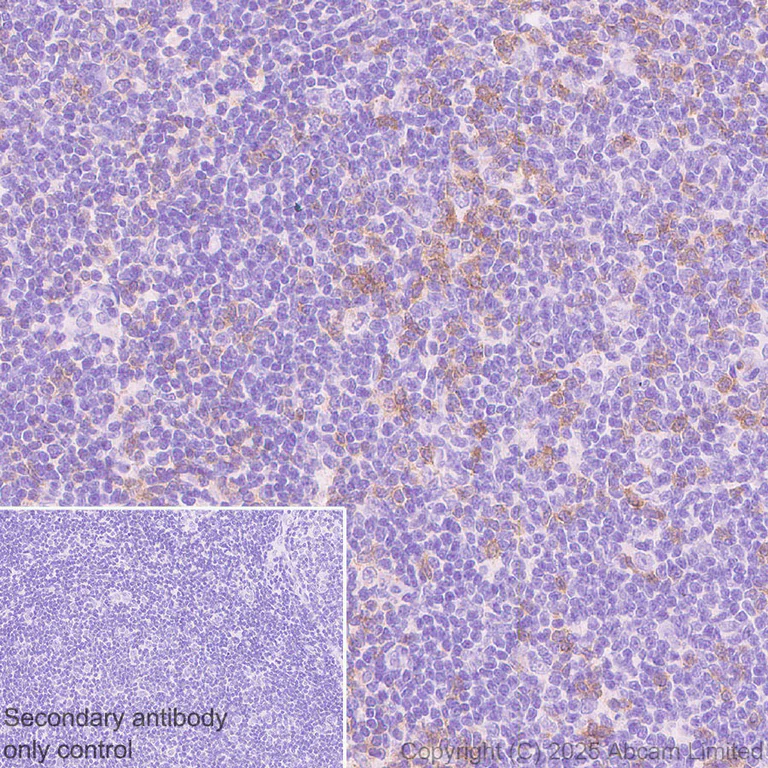 Immunohistochemistry (Formalin/PFA-fixed paraffin-embedded sections) - Anti-TIGIT antibody [EPR29350-46] (AB324237)