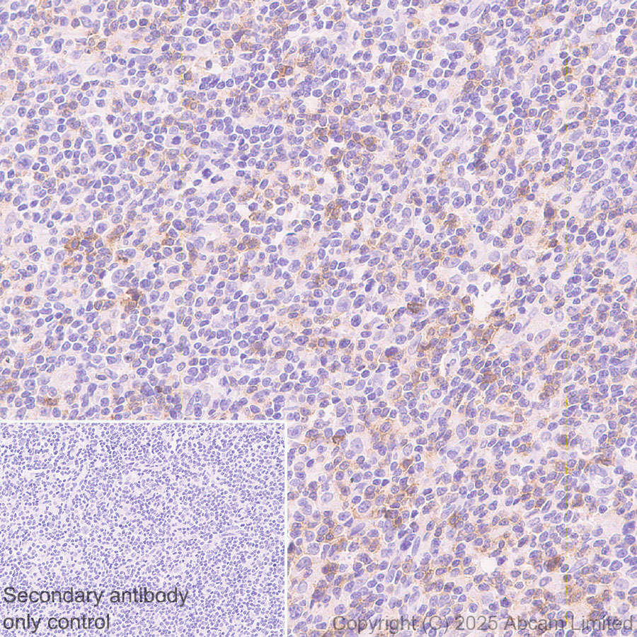 Immunohistochemistry (Formalin/PFA-fixed paraffin-embedded sections) - Anti-TIGIT antibody [EPR29350-46] (AB324237), expandable thumbnail