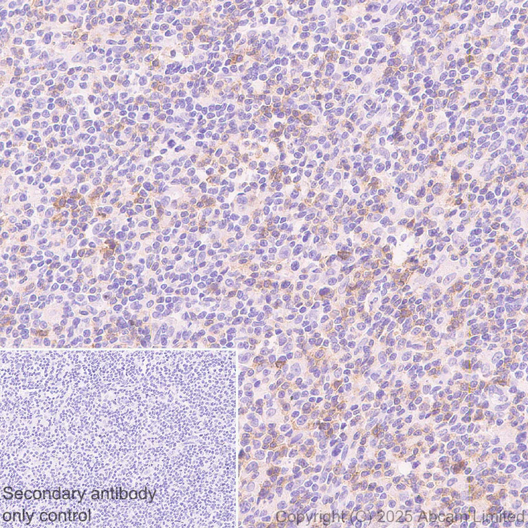 Immunohistochemistry (Formalin/PFA-fixed paraffin-embedded sections) - Anti-TIGIT antibody [EPR29350-46] (AB324237)
