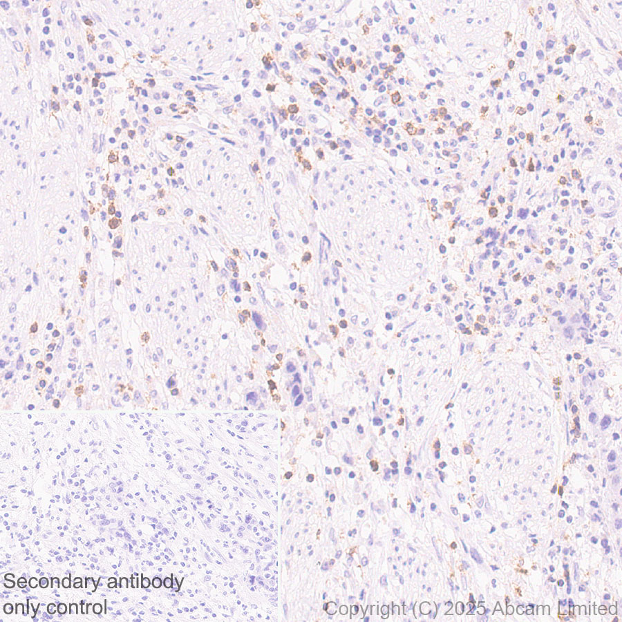Immunohistochemistry (Formalin/PFA-fixed paraffin-embedded sections) - Anti-TIGIT antibody [EPR29350-46] (ab324237), expandable thumbnail