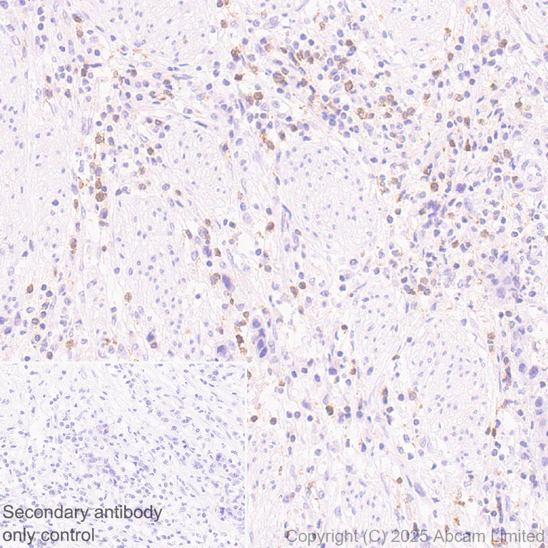 Immunohistochemistry (Formalin/PFA-fixed paraffin-embedded sections) - Anti-TIGIT antibody [EPR29350-46] (AB324237)