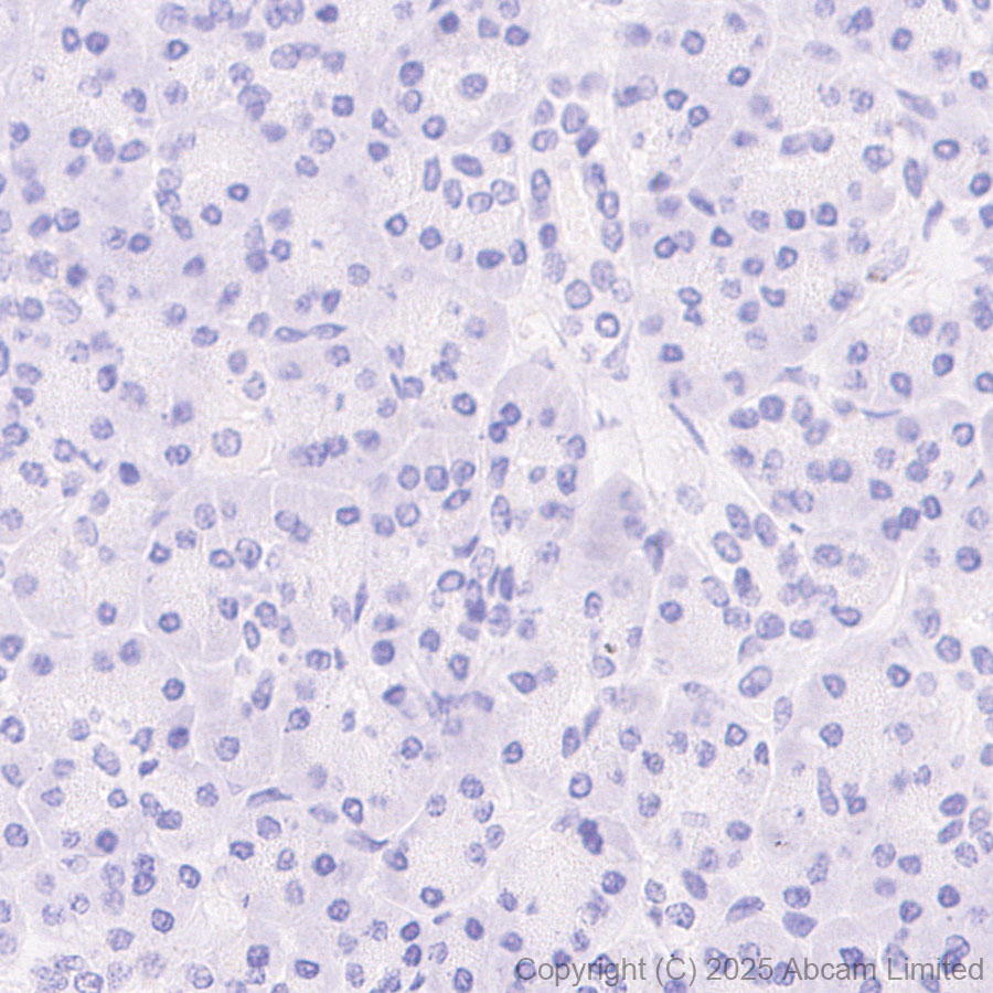 Immunohistochemistry (Formalin/PFA-fixed paraffin-embedded sections) - Anti-TIGIT antibody [EPR29350-46] (AB324237), expandable thumbnail