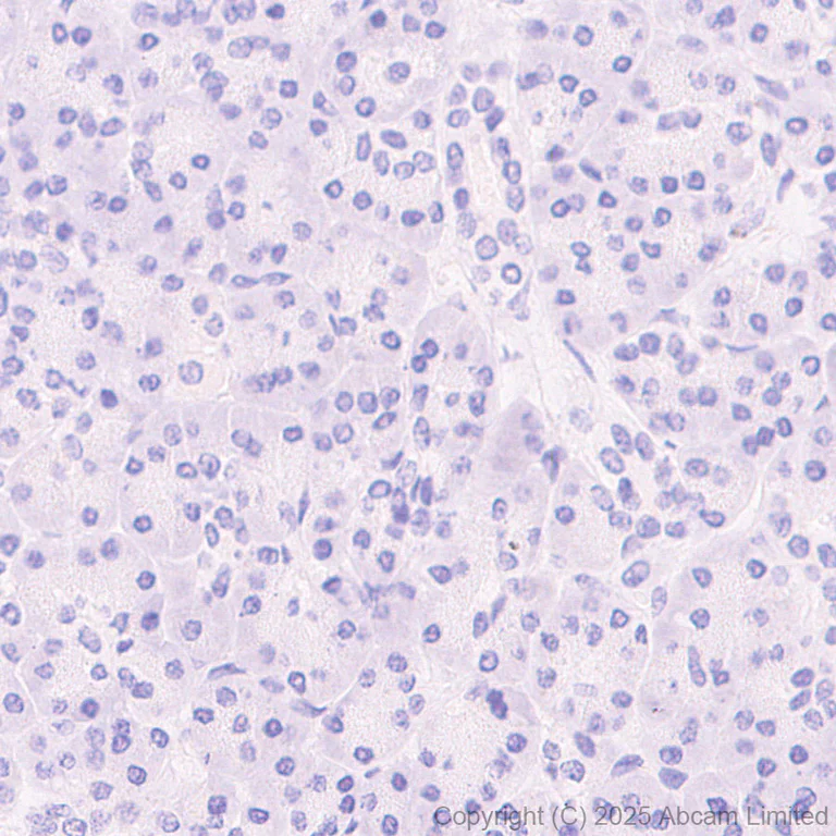 Immunohistochemistry (Formalin/PFA-fixed paraffin-embedded sections) - Anti-TIGIT antibody [EPR29350-46] (AB324237)