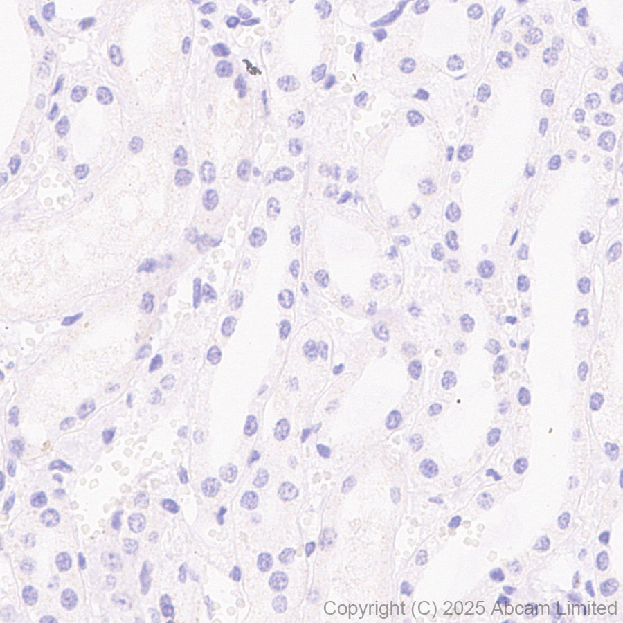 Immunohistochemistry (Formalin/PFA-fixed paraffin-embedded sections) - Anti-TIGIT antibody [EPR29350-46] (ab324237), expandable thumbnail